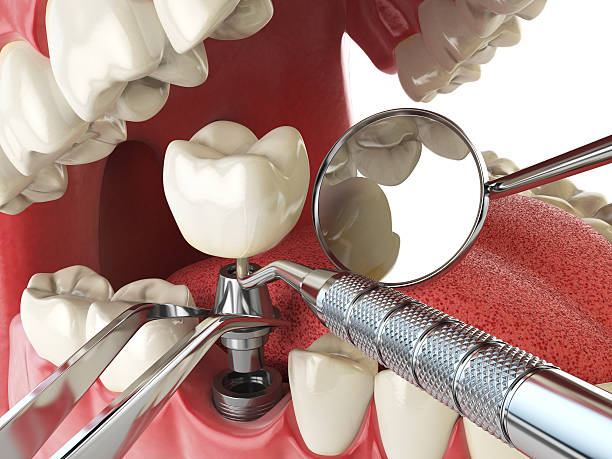 Best Urgent Care for Lost Fillings or Crowns in Moosic, PA